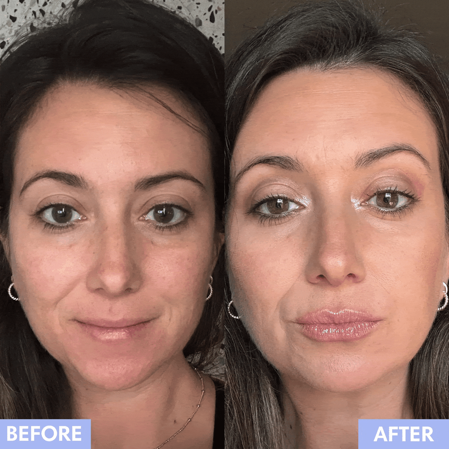 Kiss Me Kit-Lip Roller + Plumping Serum